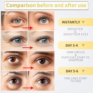 Under Eye Patches for Dark Circles and Puffiness - Under Eye Masks Anti-Aging Collagen Hyaluronic Acid